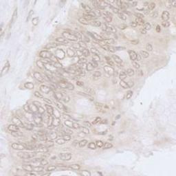 Detection of human NUP35 by immunohistochemistry.