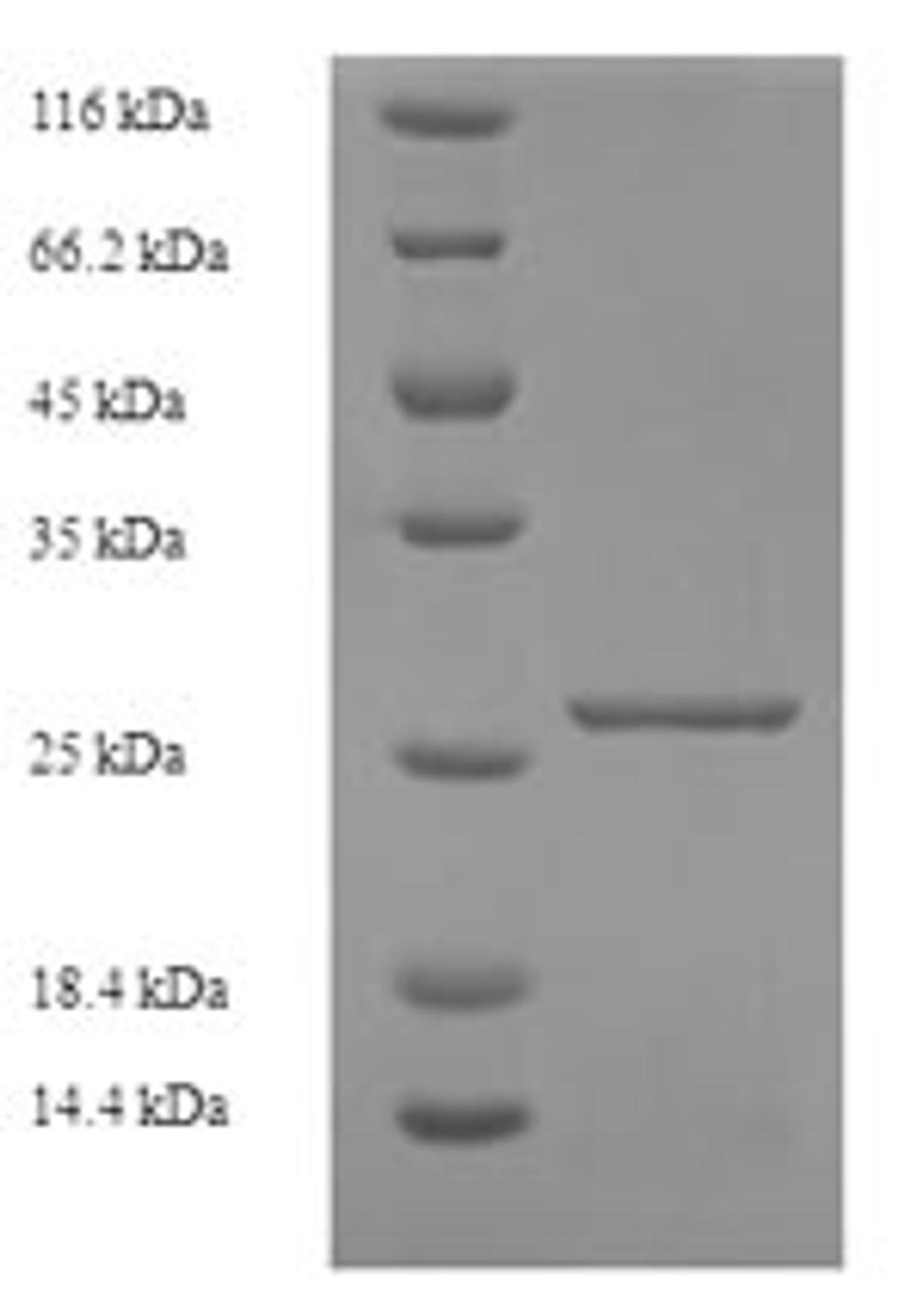 (Tris-Glycine gel) Discontinuous SDS-PAGE (reduced) with 5% enrichment gel and 15% separation gel.