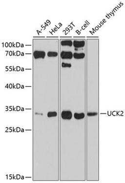 Western blot - UCK2 antibody (A10815)