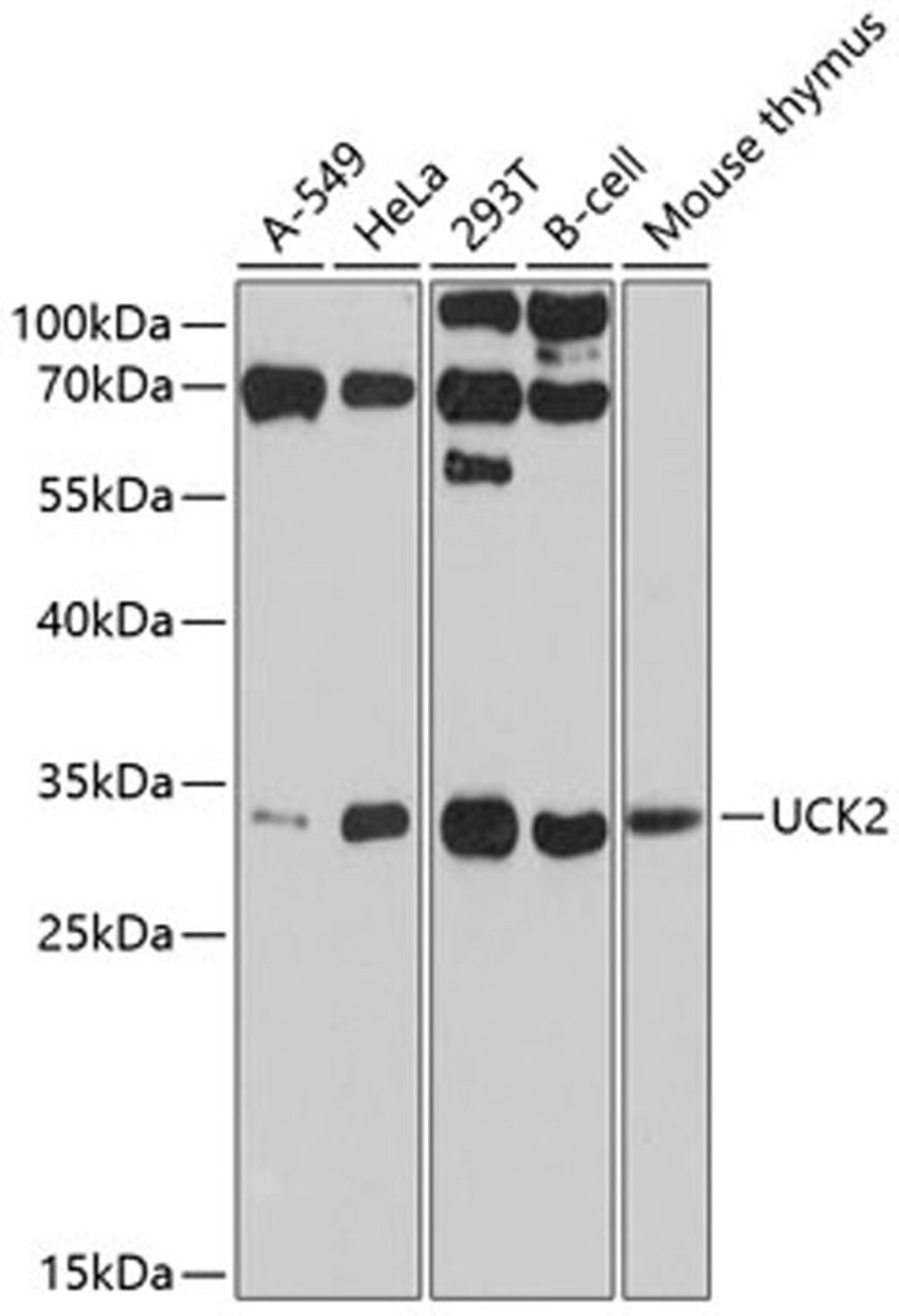 Western blot - UCK2 antibody (A10815)