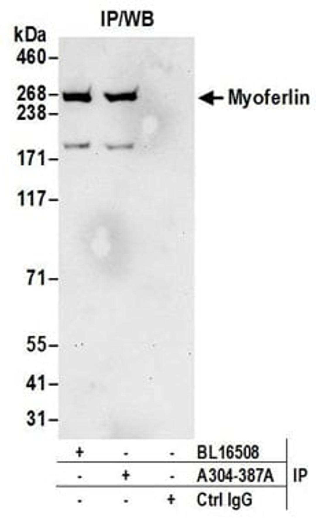 Detection of human Myoferlin by western blot of immunoprecipitates.