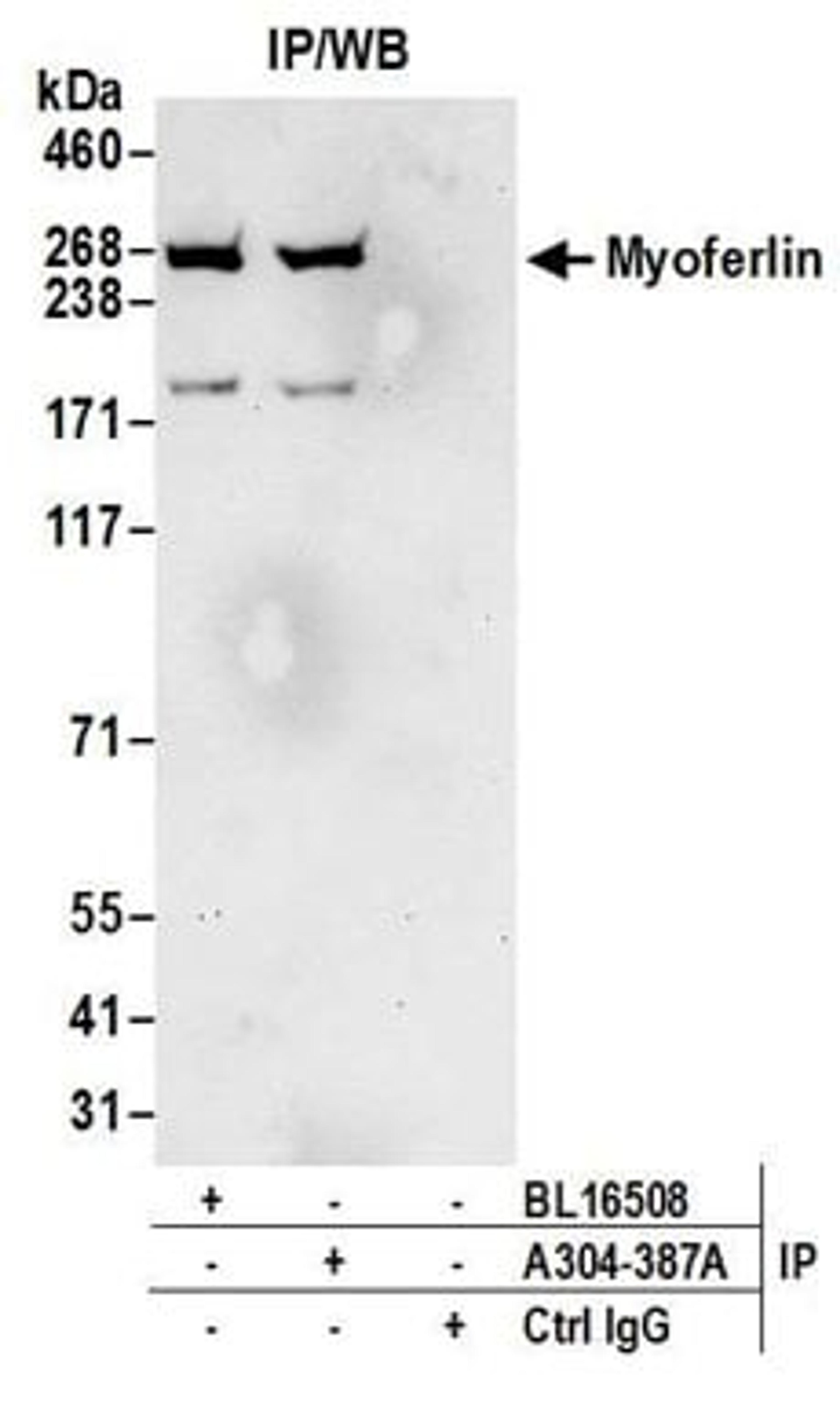 Detection of human Myoferlin by western blot of immunoprecipitates.