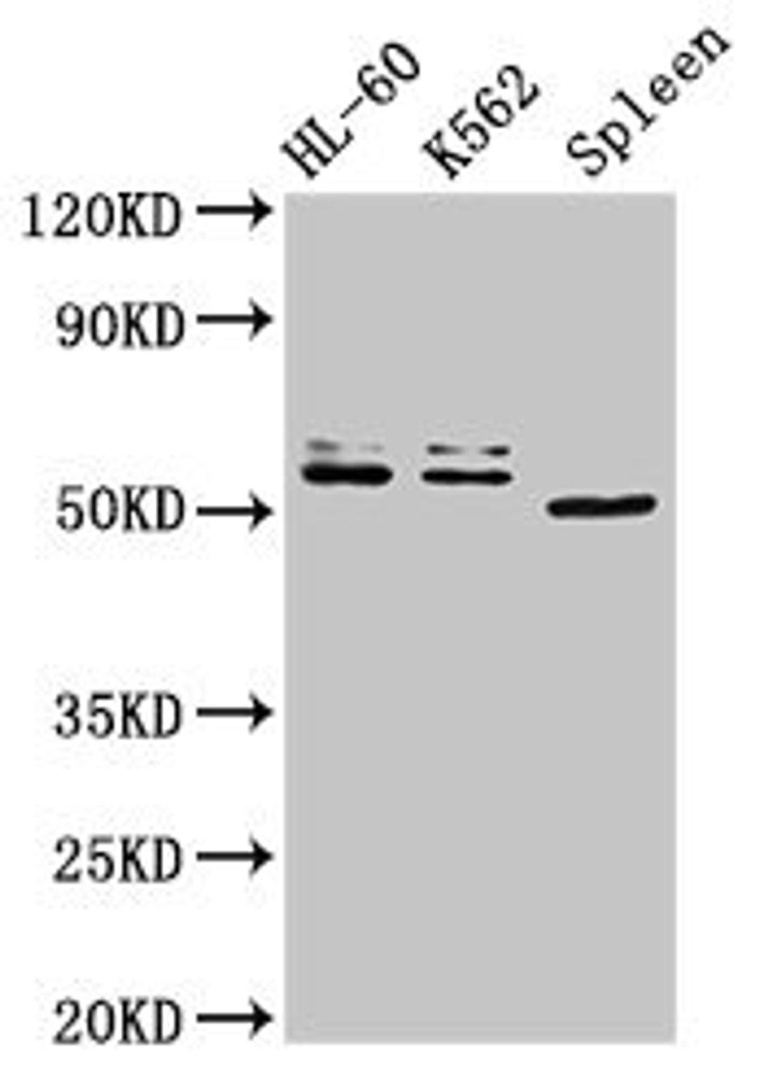Western Blot. Positive WB detected in: HL60 whole cell lysate, K562 whole cell lysate, Mouse spleen tissue. All lanes: API5 antibody at 3ug/ml. Secondary. Goat polyclonal to rabbit IgG at 1/50000 dilution. Predicted band size: 60, 50, 57, 51, 58 kDa. Observed band size: 60, 50 kDa