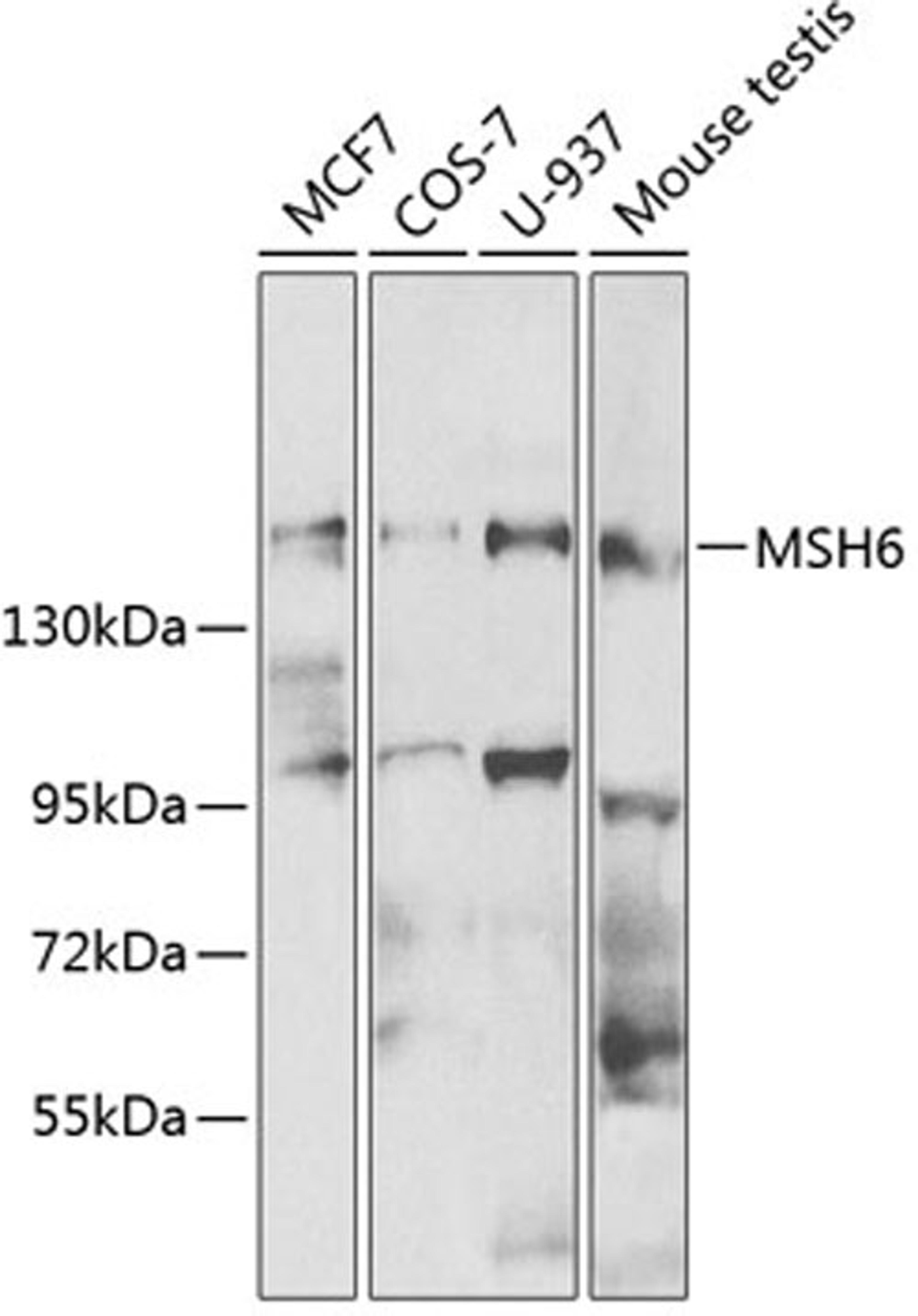 Western blot - MSH6 antibody (A0983)