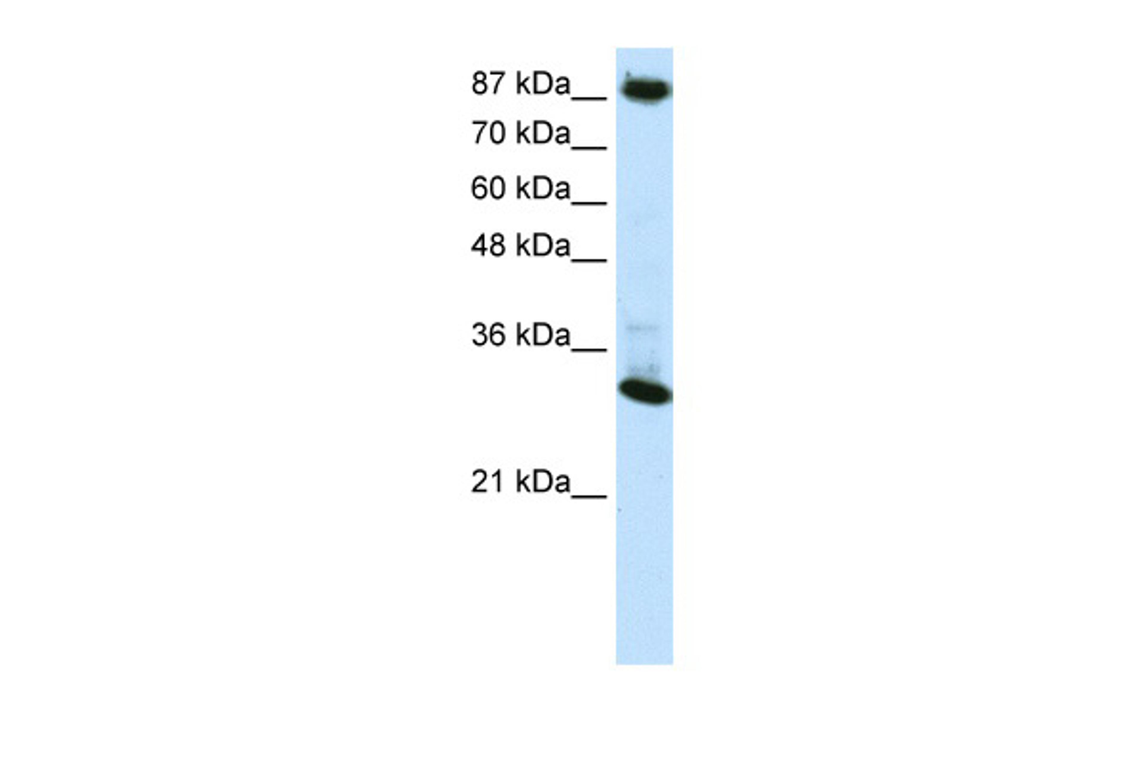 Antibody used in WB on Human 293T at 0.2-1 ug/ml.