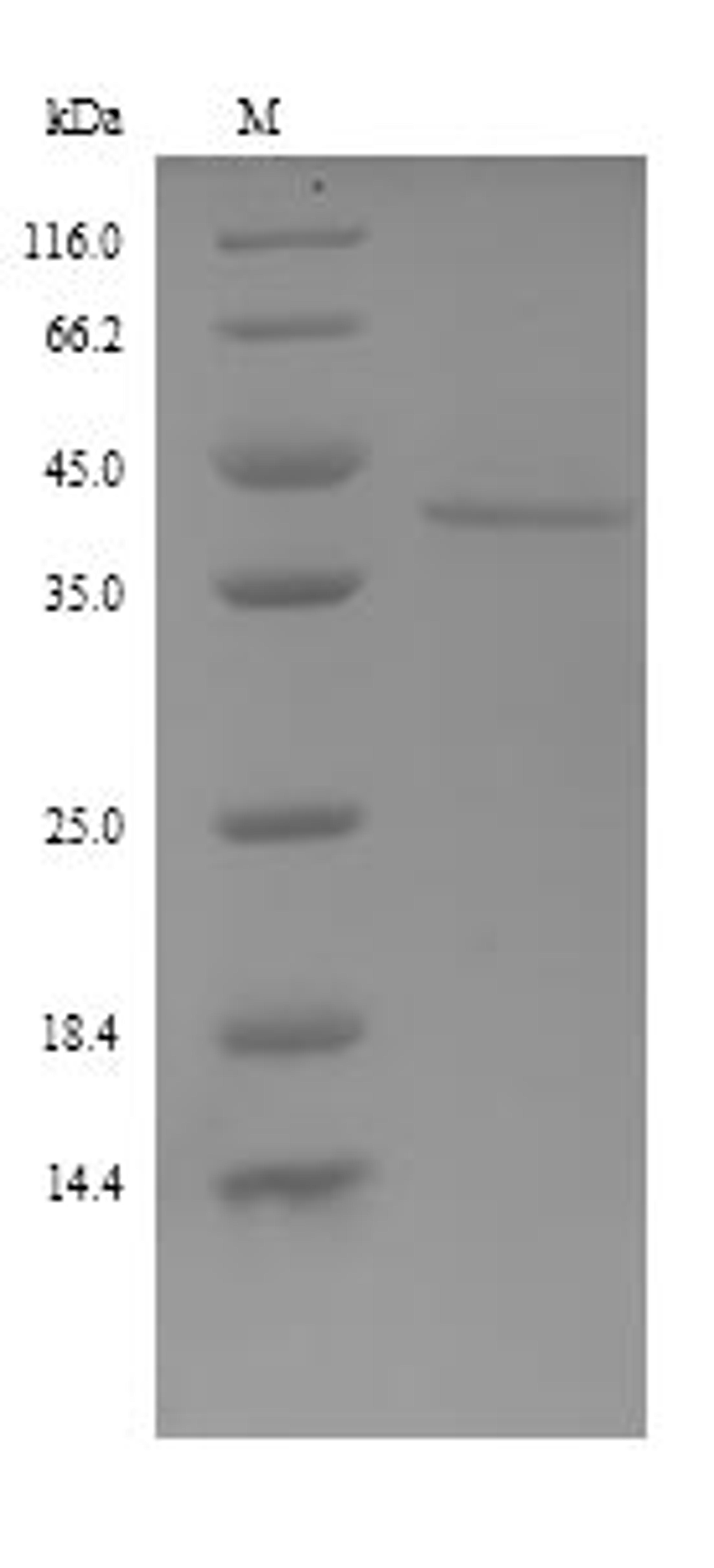 (Tris-Glycine gel) Discontinuous SDS-PAGE (reduced) with 5% enrichment gel and 15% separation gel.