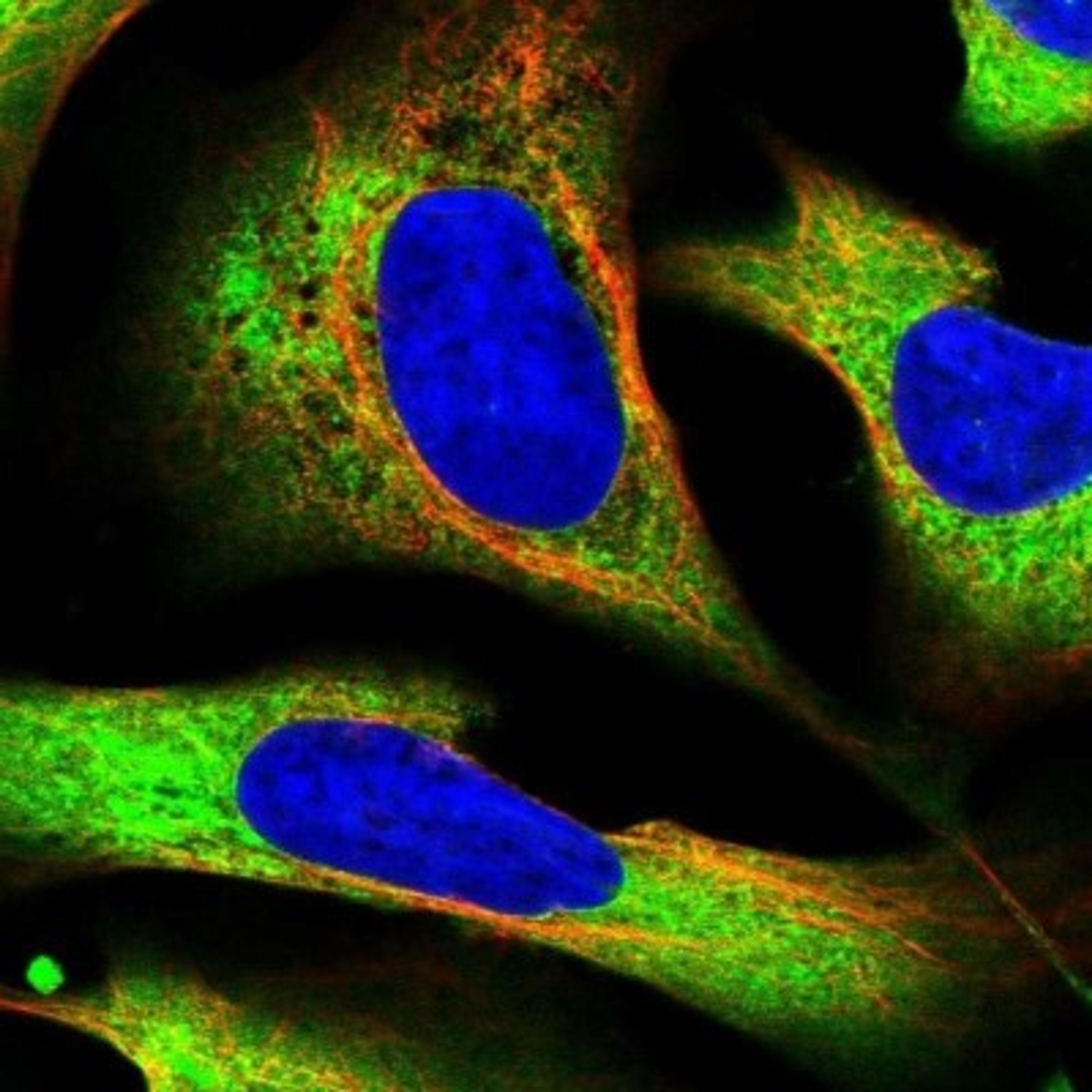 Immunocytochemistry: EEF1D Antibody [NBP1-91861] - Staining of human cell line U-2 OS shows positivity in endoplasmic reticulum.