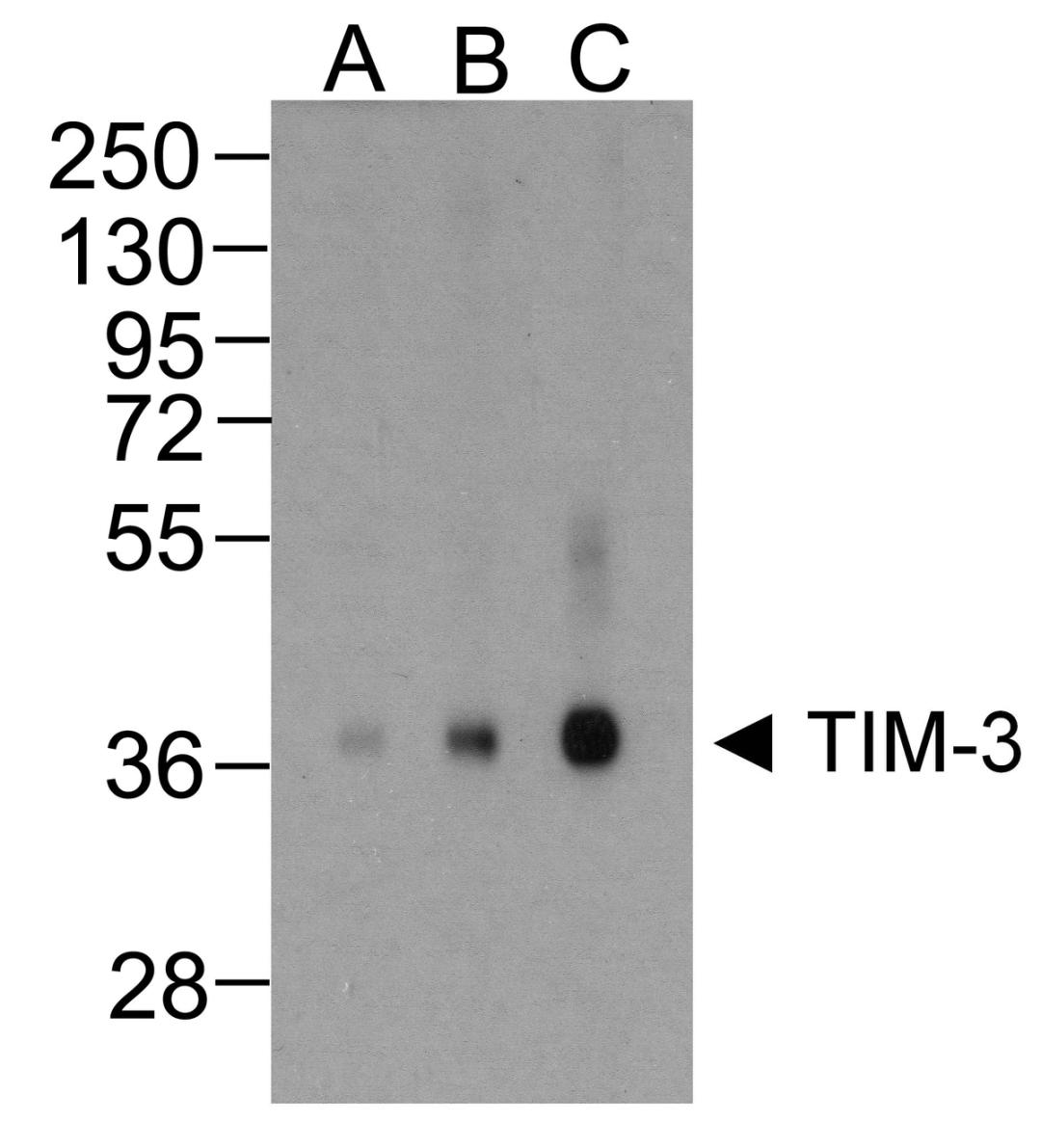 Western blot analysis of TIM-3 in overexpressing HEK293 cells TIM-3 antibody at (A) 0.25, (B) 0.5, and (C) 1 &#956;g/ml