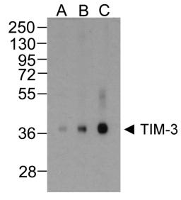 Western blot analysis of TIM-3 in overexpressing HEK293 cells TIM-3 antibody at (A) 0.25, (B) 0.5, and (C) 1 &#956;g/ml