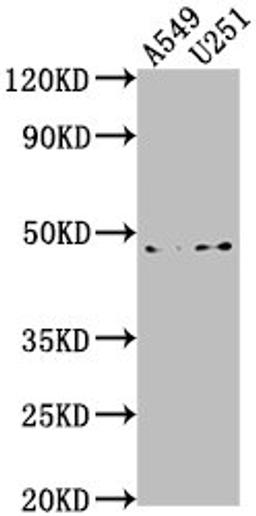 Western Blot. Positive WB detected in: A549 whole cell lysate, U251 whole cell lysate. All lanes: B4GALT6 antibody at 1:1000. Secondary. Goat polyclonal to rabbit IgG at 1/50000 dilution. Predicted band size: 45, 41 kDa. Observed band size: 45 kDa.
