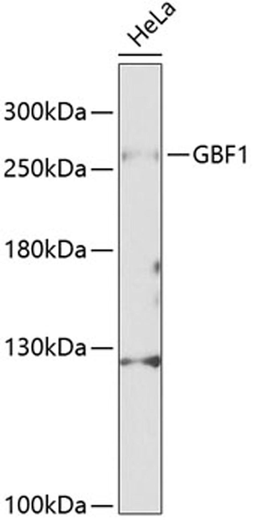 Western blot - GBF1 Antibody (A12539)