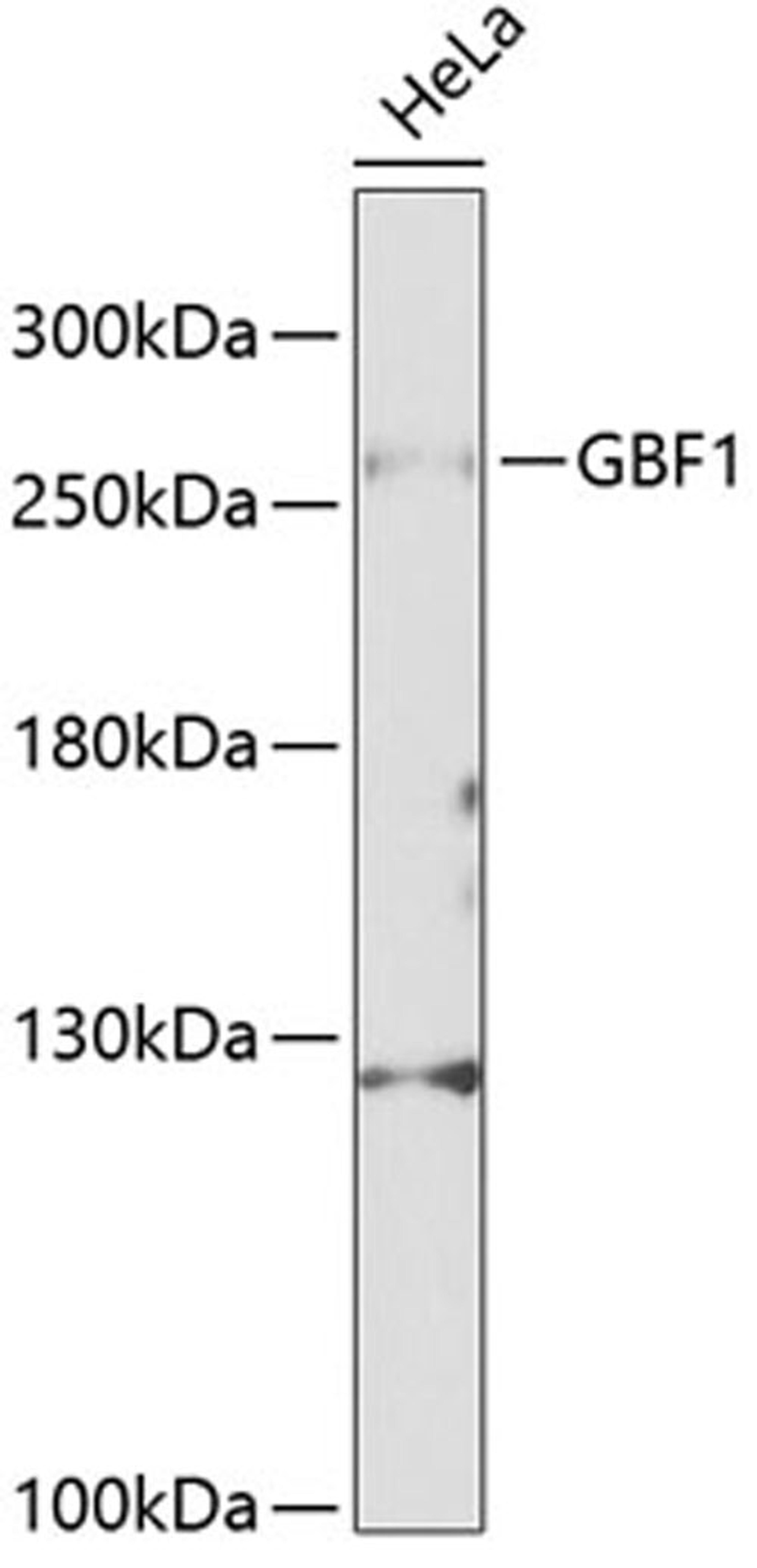 Western blot - GBF1 Antibody (A12539)