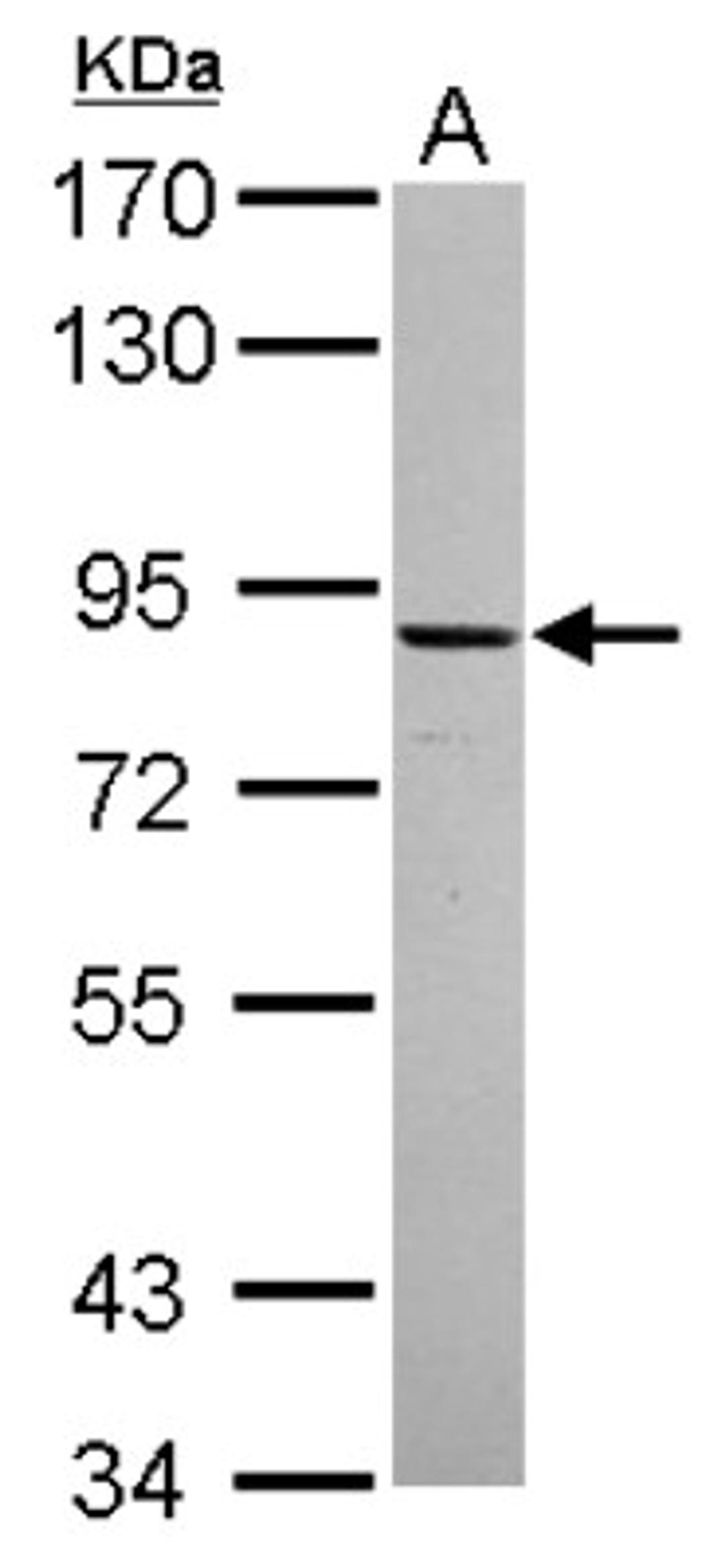 Western Blot: ADAM22 Antibody [NBP2-15282] - Sample (30 ug of whole cell lysate) A: IMR32 7.5% SDS PAGE, antibody diluted at 1:500.