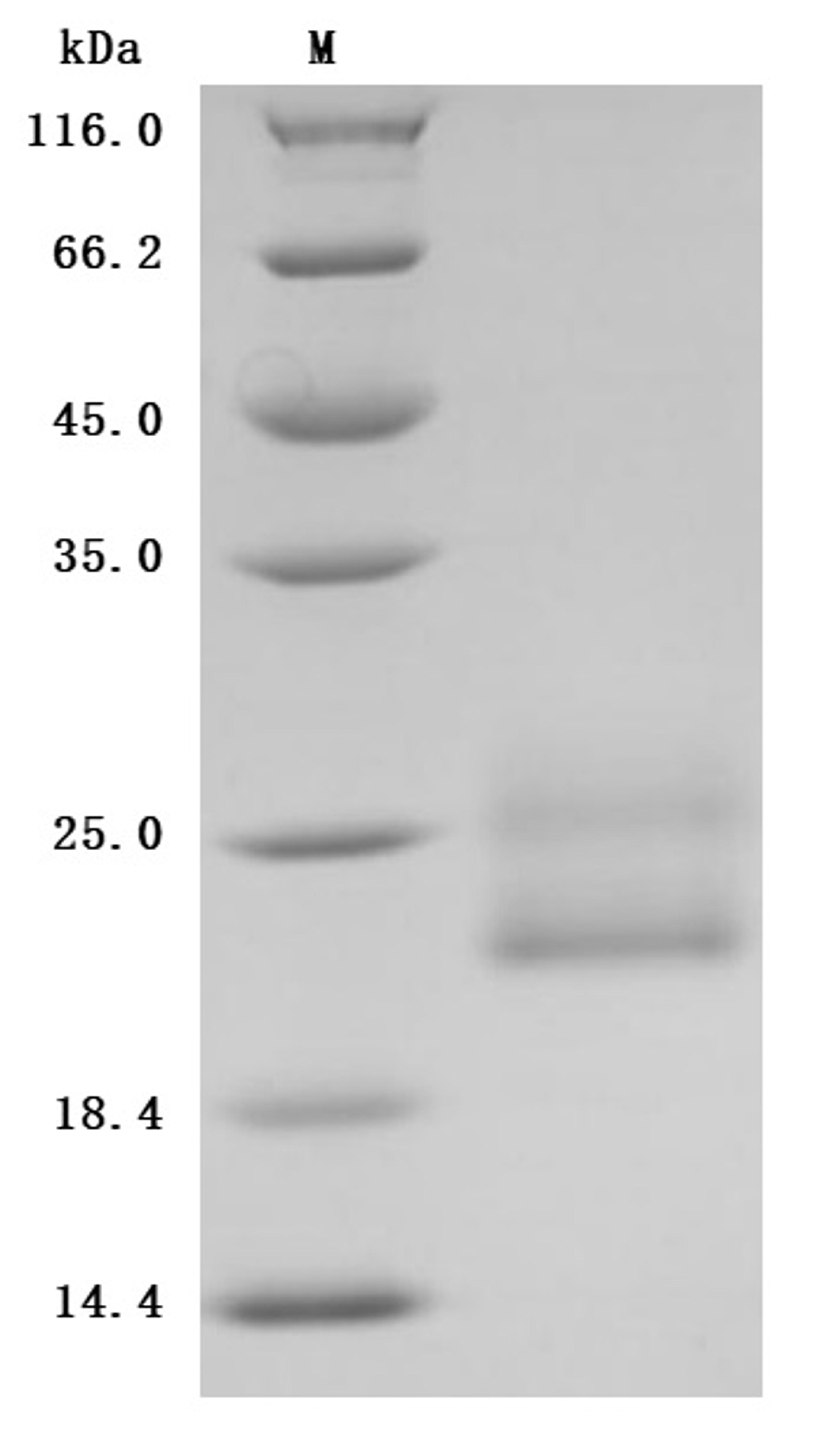 (Tris-Glycine gel) Discontinuous SDS-PAGE (reduced) with 5% enrichment gel and 15% separation gel.