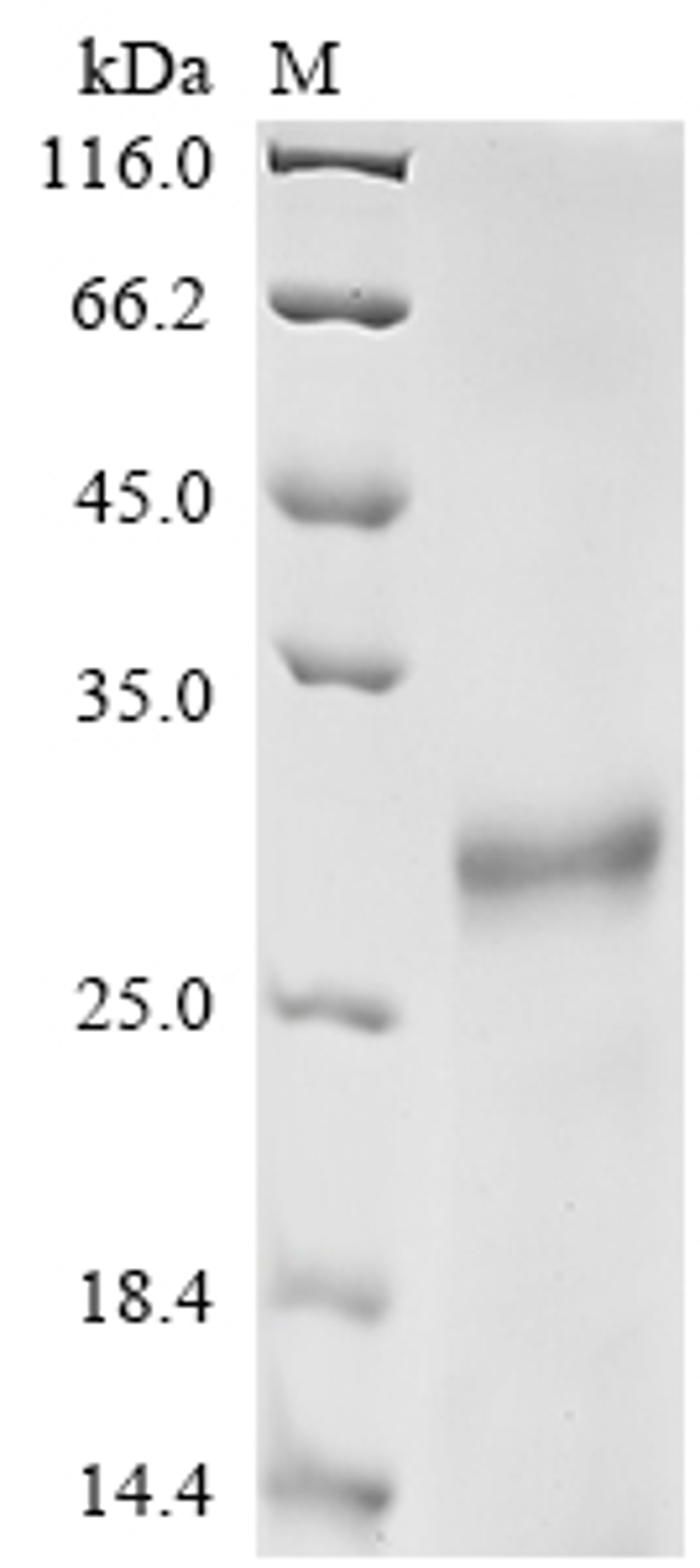 (Tris-Glycine gel) Discontinuous SDS-PAGE (reduced) with 5% enrichment gel and 15% separation gel.