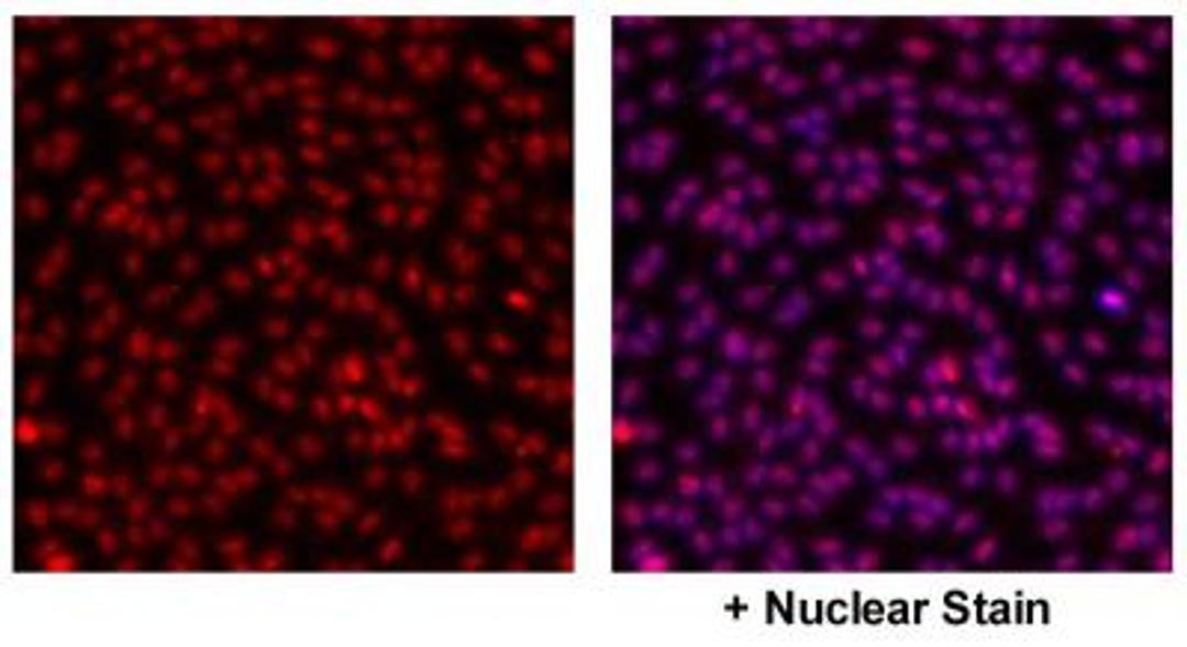 Immunocytochemistry/Immunofluorescence: GPER/GPR30 Antibody [NBP1-31239] - Detection of GPER/GPR30 in HUVEC nucleus. Image courtesy of a product review by Dr. Subhadeep Chakrabarti of University of Alberta.