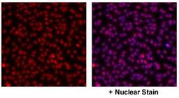 Immunocytochemistry/Immunofluorescence: GPER/GPR30 Antibody [NBP1-31239] - Detection of GPER/GPR30 in HUVEC nucleus. Image courtesy of a product review by Dr. Subhadeep Chakrabarti of University of Alberta.