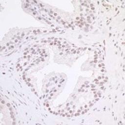 Detection of human MAZ/SAF-1 by immunohistochemistry.