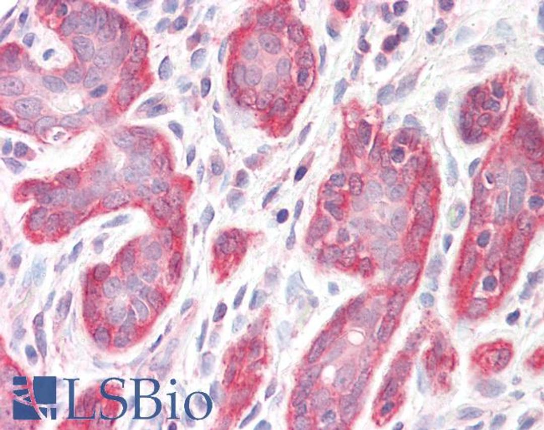 46-158 (3.75ug/ml) staining of paraffin embedded Human Breast. Steamed antigen retrieval with citrate buffer pH 6, AP-staining.