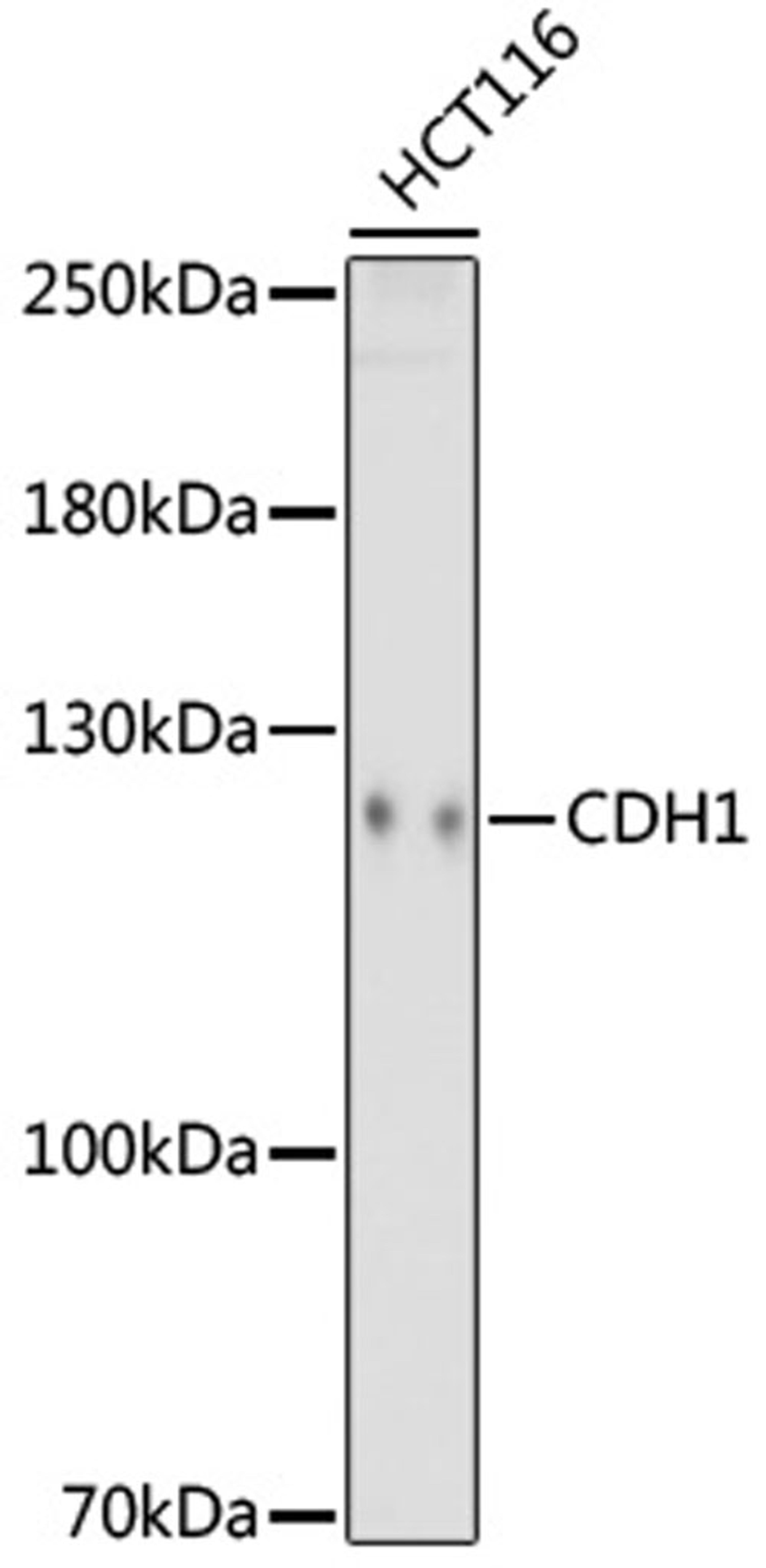 Western blot - CDH1 antibody (A18135)