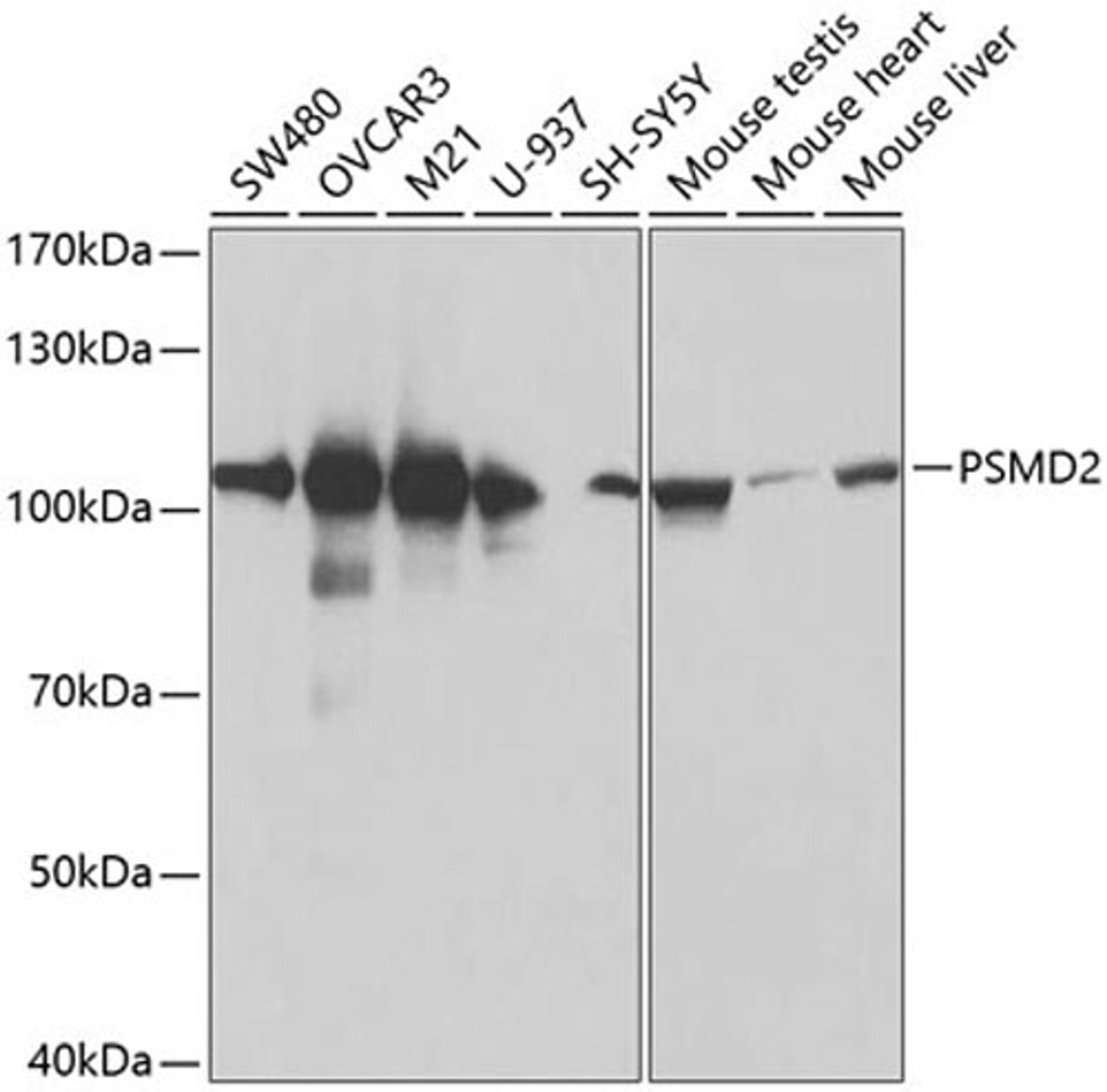 Western blot - PSMD2 antibody (A1999)