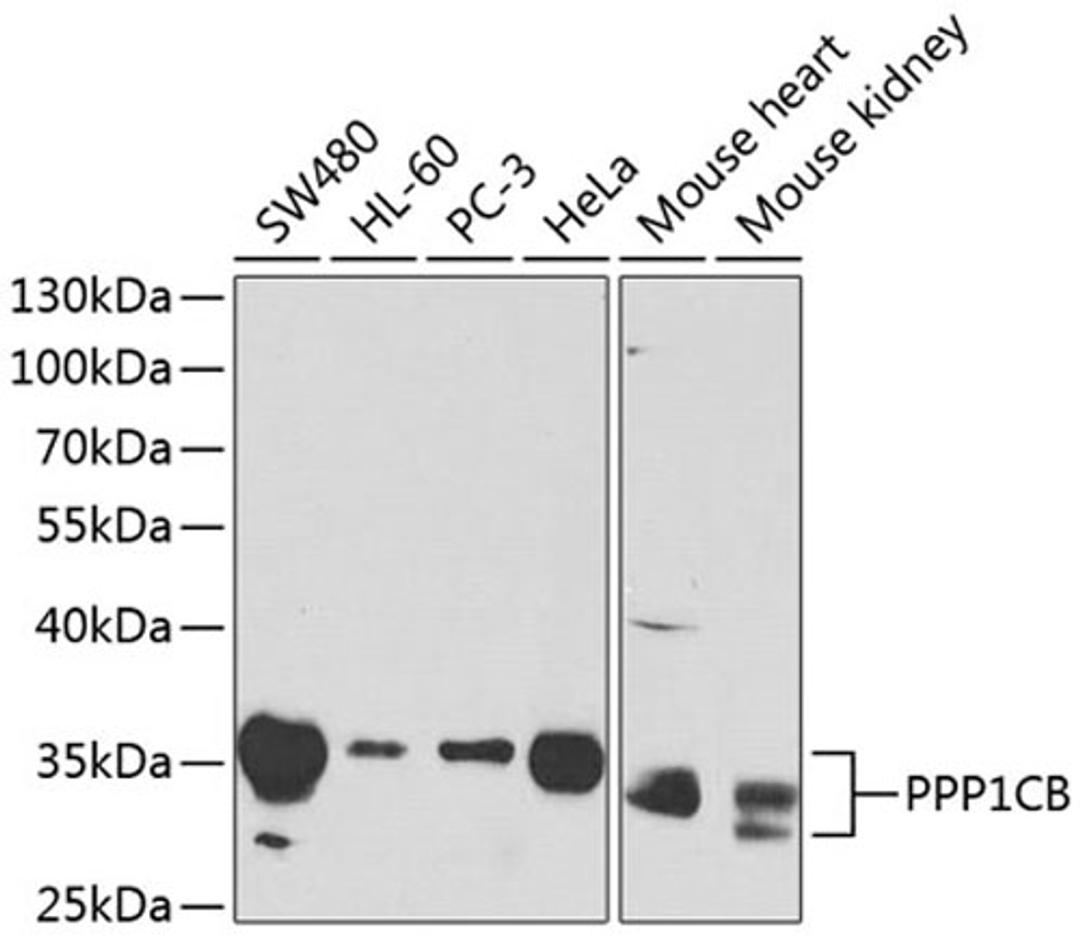 Western blot - PPP1CB antibody (A1088)