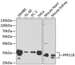 Western blot - PPP1CB antibody (A1088)