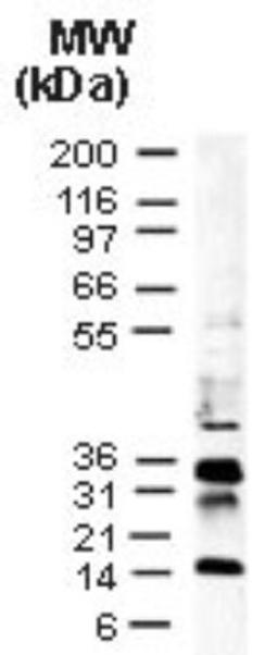 Western Blot: p35 baculovirus Antibody [NB100-56153] - Analysis of in vitro translated p35 baculovirus protein using this antibody. Full-length p35 is detected at ~35 kDa, lower molecular p35 breakdown/cleavage bands are also detected.