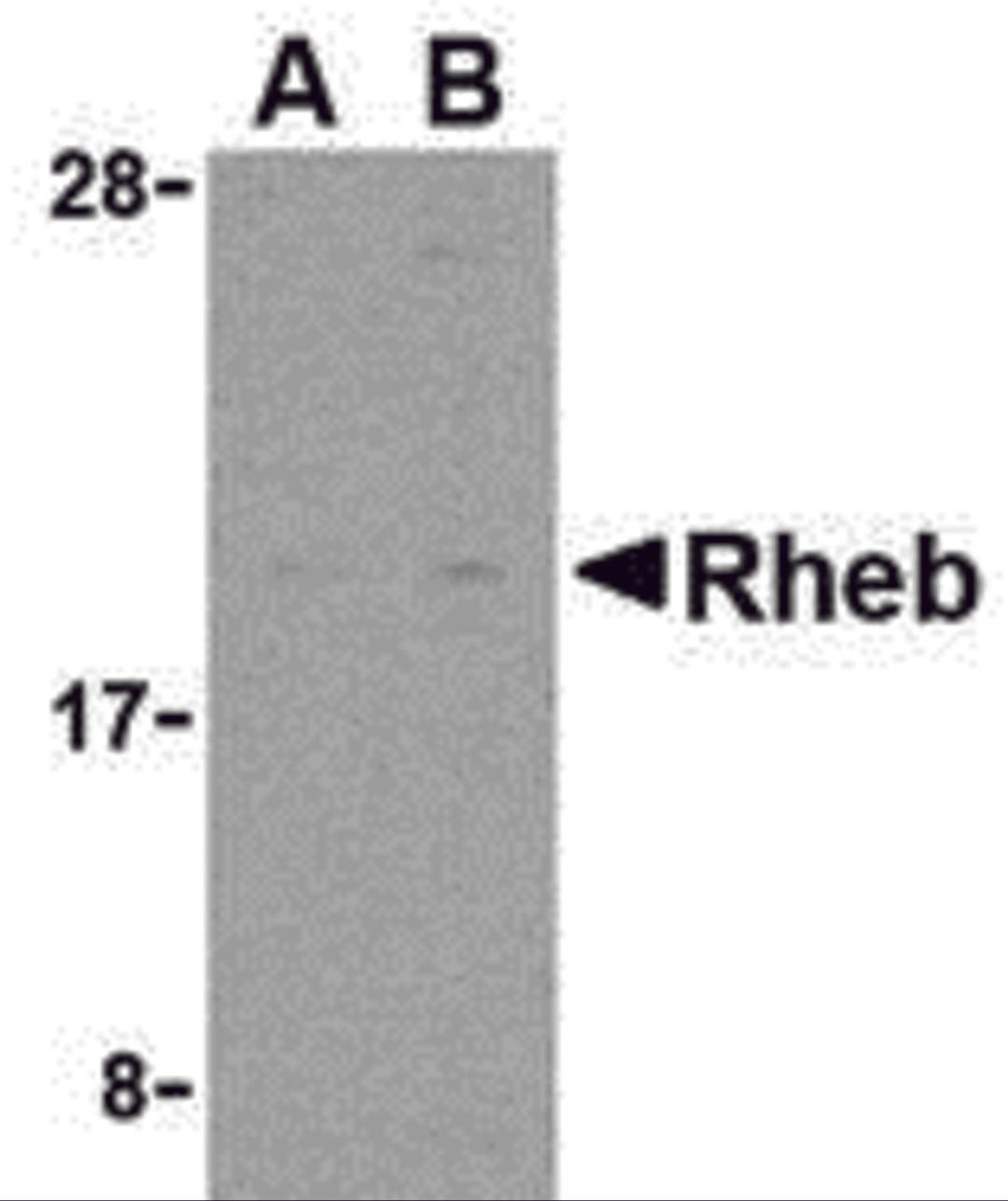 Western blot analysis of Rheb in rat heart cell lysate with Rheb antibody at (A) 2 and (B) 4 μg/mL.