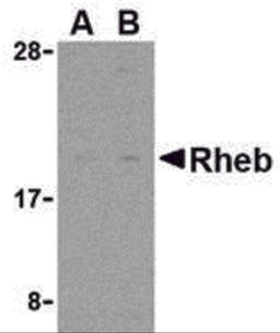 Western blot analysis of Rheb in rat heart cell lysate with Rheb antibody at (A) 2 and (B) 4 μg/mL.