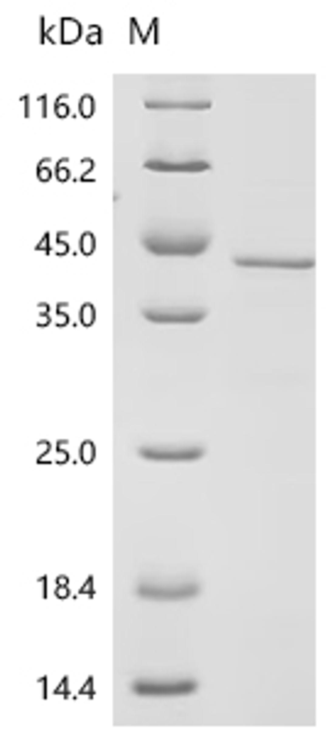 (Tris-Glycine gel) Discontinuous SDS-PAGE (reduced) with 5% enrichment gel and 15% separation gel.