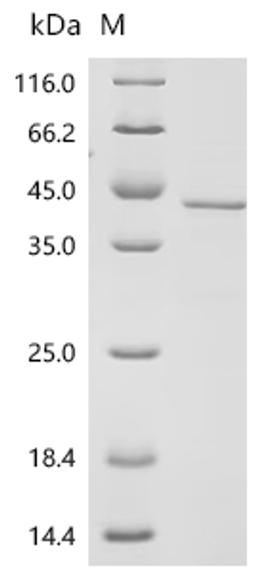 (Tris-Glycine gel) Discontinuous SDS-PAGE (reduced) with 5% enrichment gel and 15% separation gel.