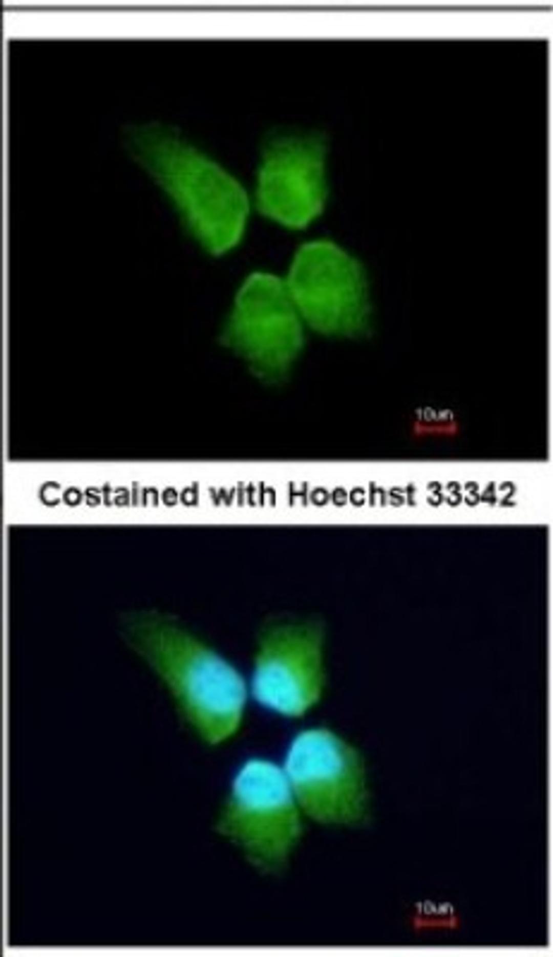 Immunocytochemistry/Immunofluorescence: GINS4 Antibody [NBP2-16659] - Immunofluorescence analysis of paraformaldehyde-fixed A431, using antibody at 1:200 dilution.