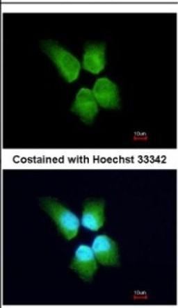 Immunocytochemistry/Immunofluorescence: GINS4 Antibody [NBP2-16659] - Immunofluorescence analysis of paraformaldehyde-fixed A431, using antibody at 1:200 dilution.