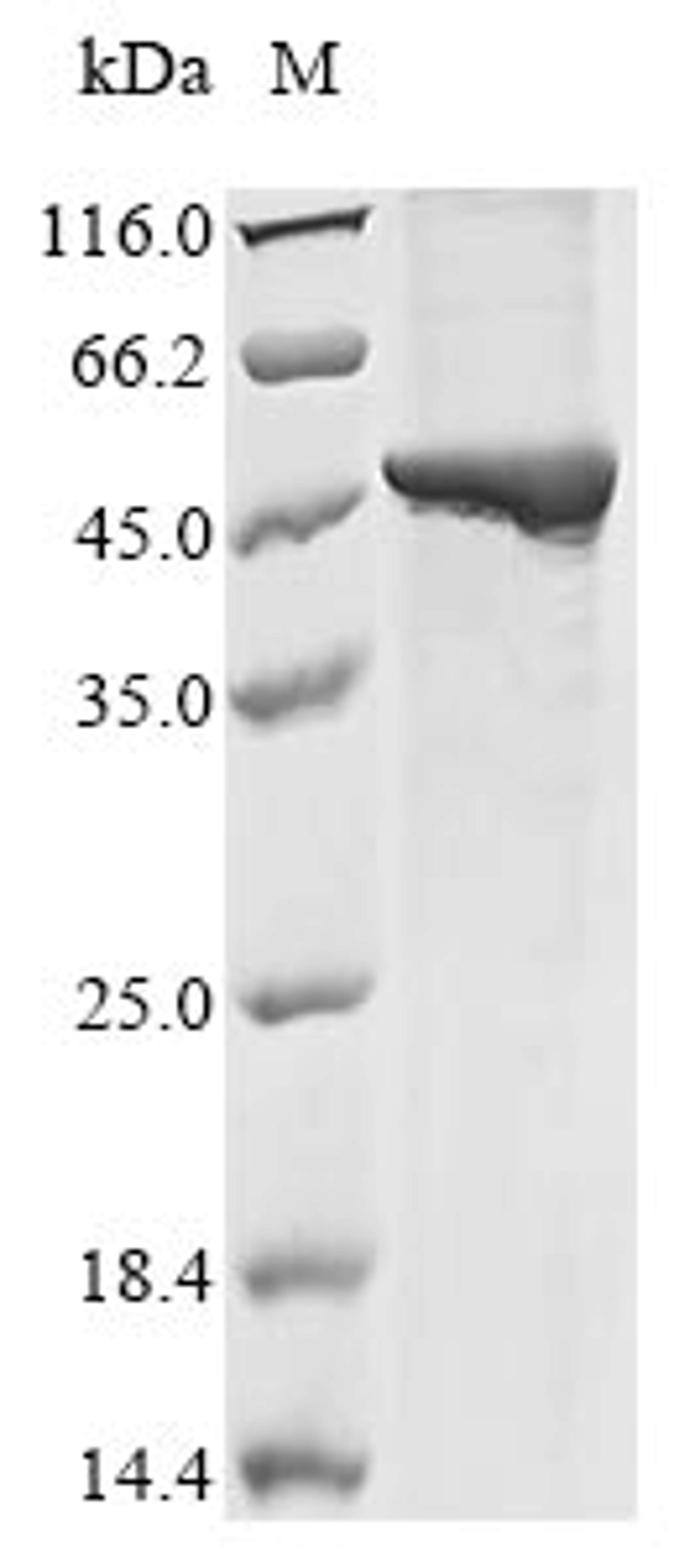 (Tris-Glycine gel) Discontinuous SDS-PAGE (reduced) with 5% enrichment gel and 15% separation gel.