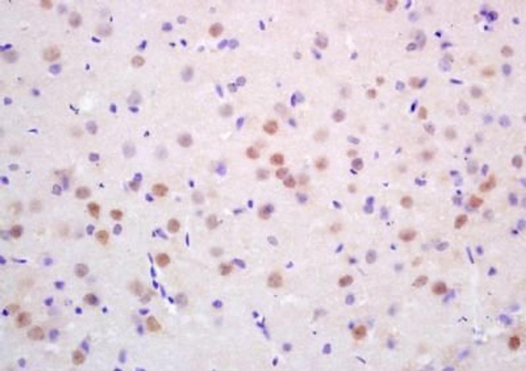 Immunohistochemical analysis of formalin-fixed paraffin embedded Rat brain tissue using CDC3 antibody (dilution at 1:200)