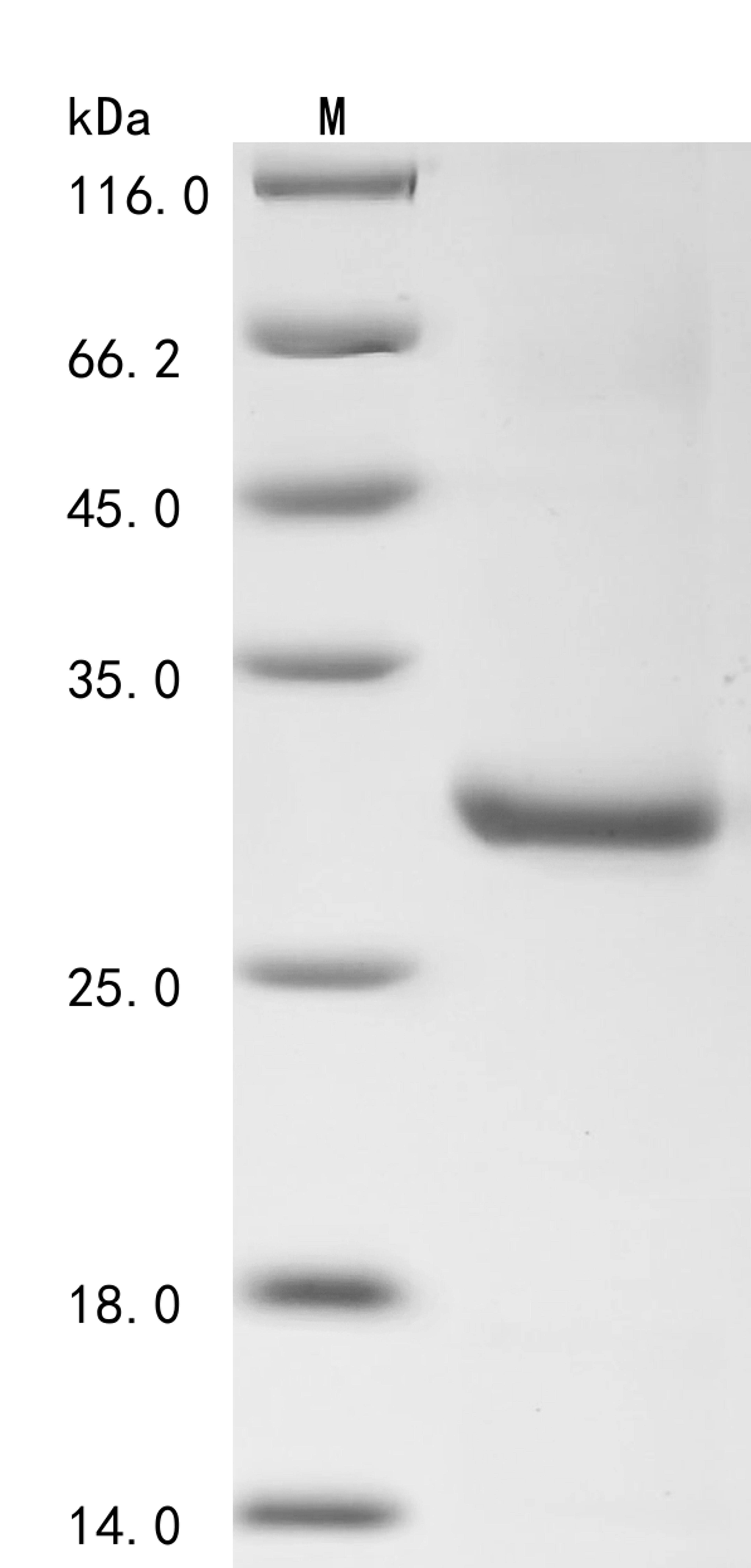(Tris-Glycine gel) Discontinuous SDS-PAGE (reduced) with 5% enrichment gel and 15% separation gel.