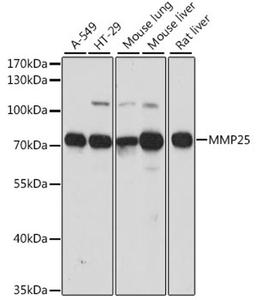 Western blot - MMP25 antibody (A15886)