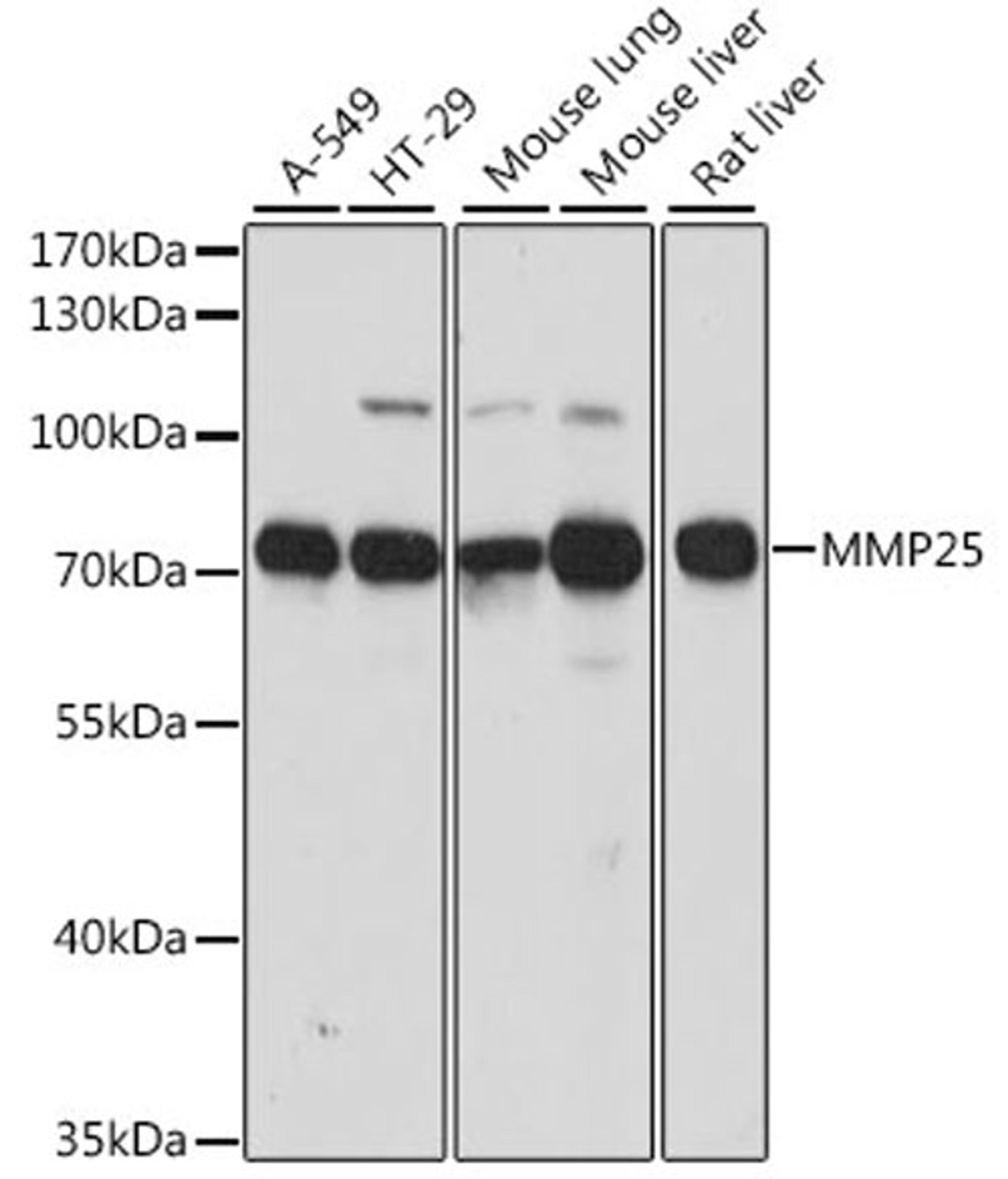 Western blot - MMP25 antibody (A15886)