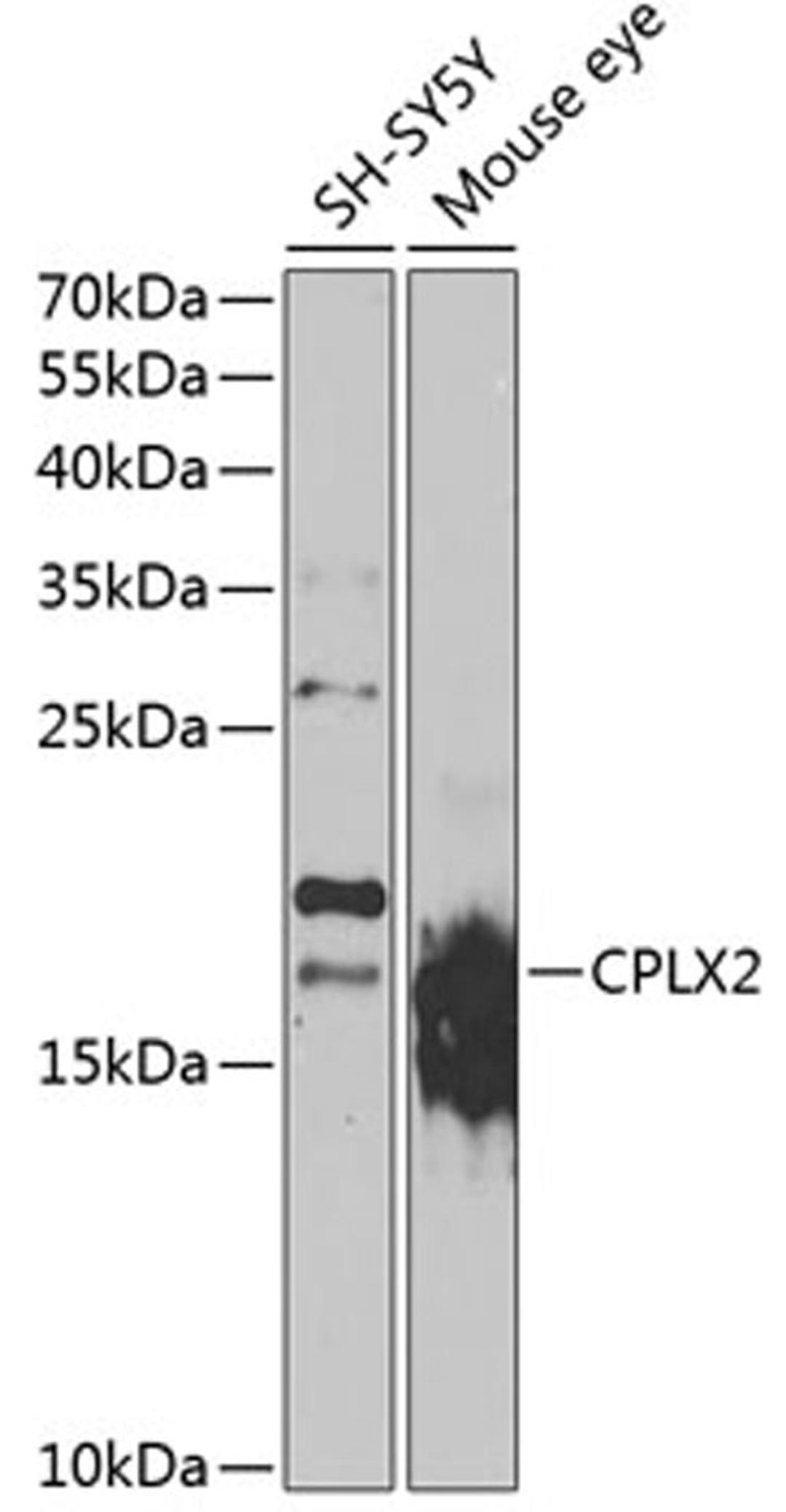 Western blot - CPLX2 antibody (A7774)