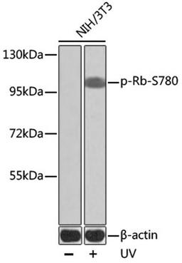 Western blot - Phospho-Rb-S780 antibody (AP0444)