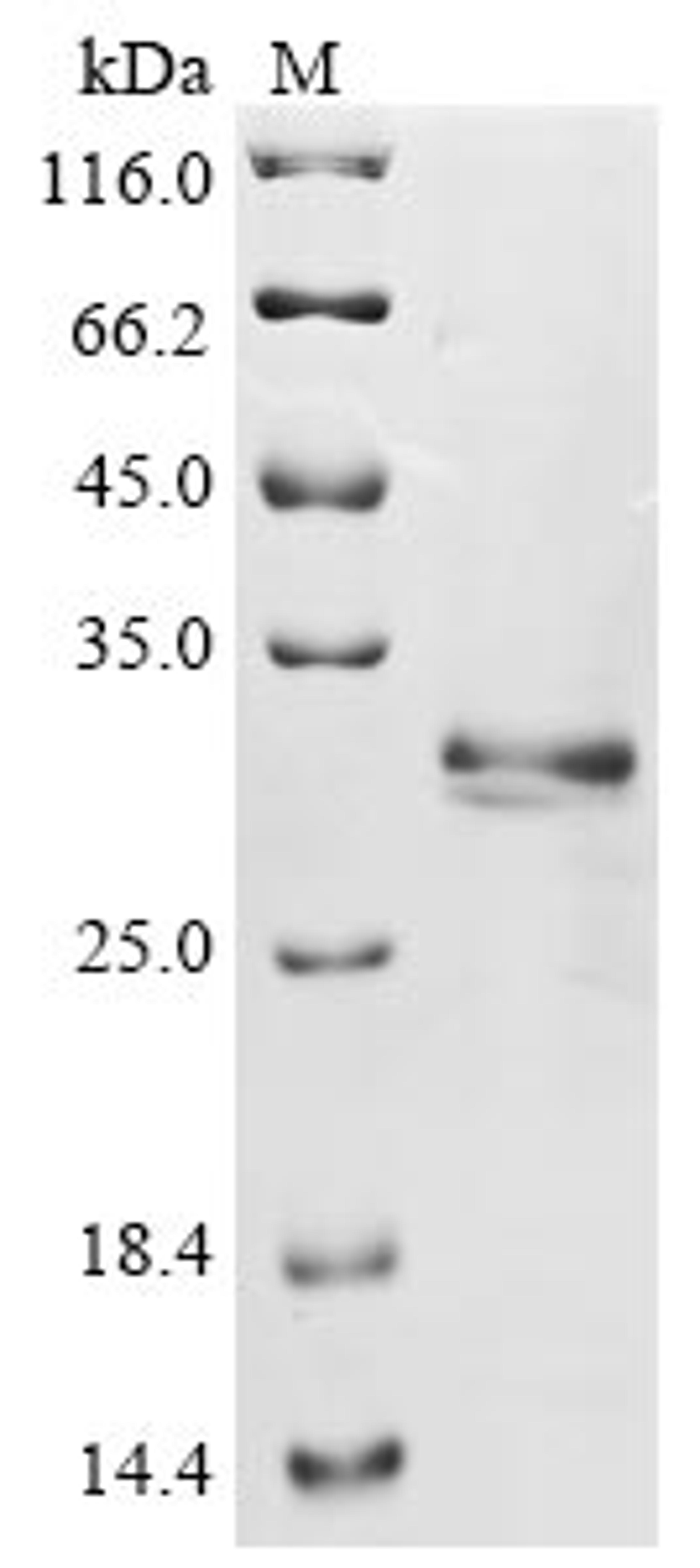 (Tris-Glycine gel) Discontinuous SDS-PAGE (reduced) with 5% enrichment gel and 15% separation gel.