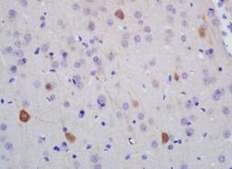 Immunohistochemical analysis of formalin-fixed paraffin embedded rat brain tissue using NF-H antibody (dilution at 1:200)