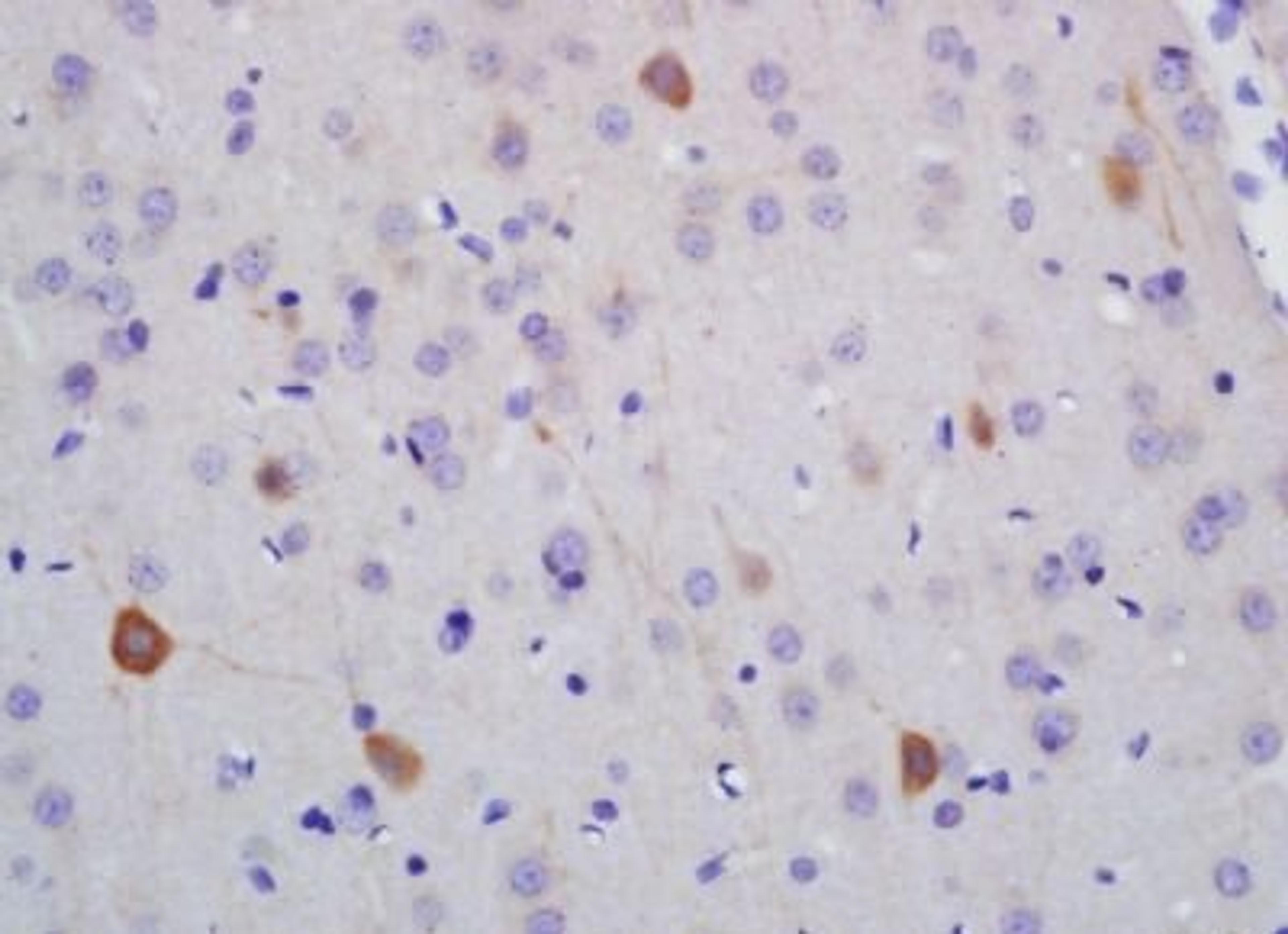 Immunohistochemical analysis of formalin-fixed paraffin embedded rat brain tissue using NF-H antibody (dilution at 1:200)