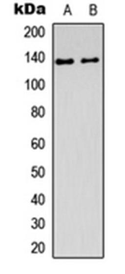 Western blot analysis of Jurkat (Lane1), Y79 (Lane2) whole cell using DDX8 antibody