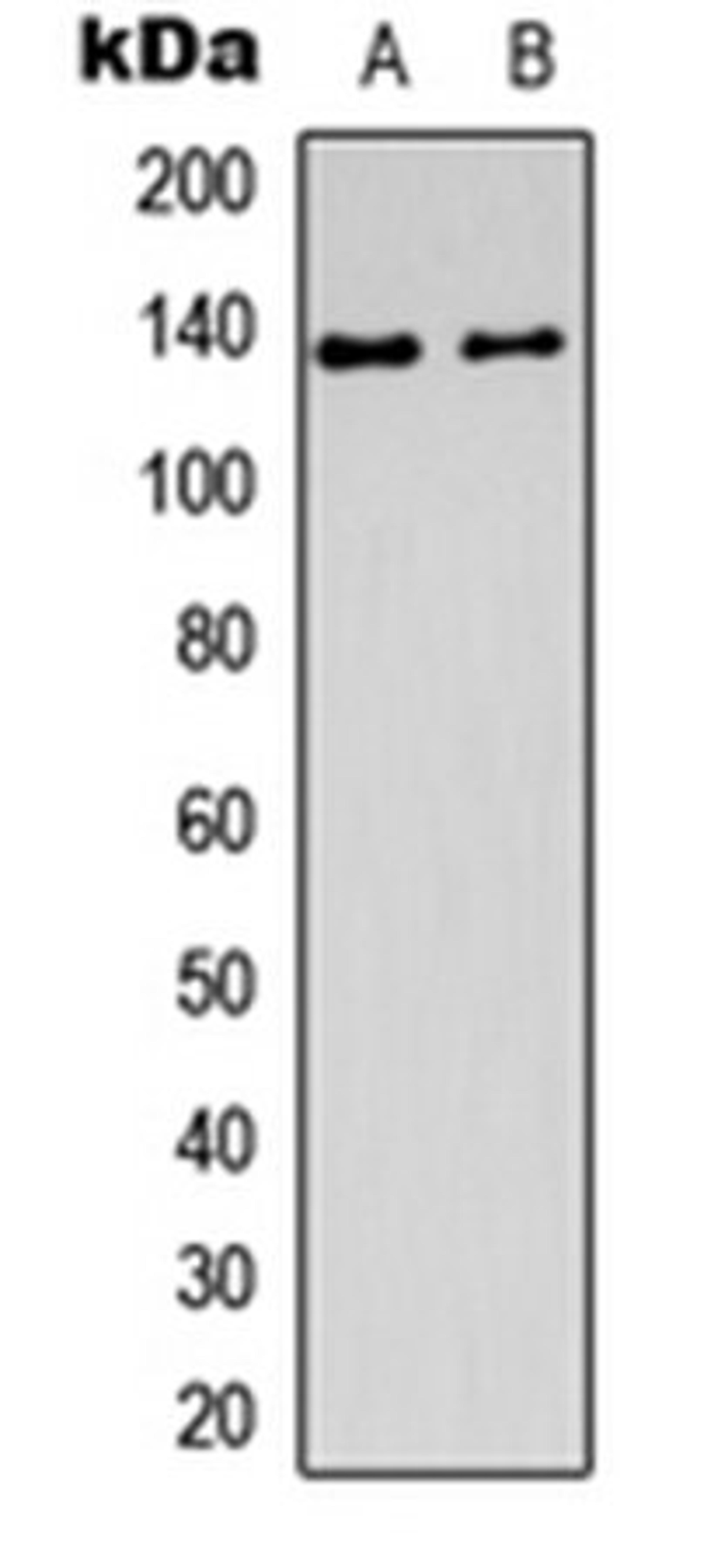 Western blot analysis of Jurkat (Lane1), Y79 (Lane2) whole cell using DDX8 antibody