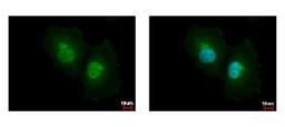 Immunocytochemistry/Immunofluorescence: Argininosuccinate Lyase Antibody [NBP1-32752] - Sample: HeLa cells were fixed in 4% paraformaldehyde at RT for 15 min. Green: ASL protein stained by ASL antibody diluted at 1:500. Blue: Hoechst 33342 staining.