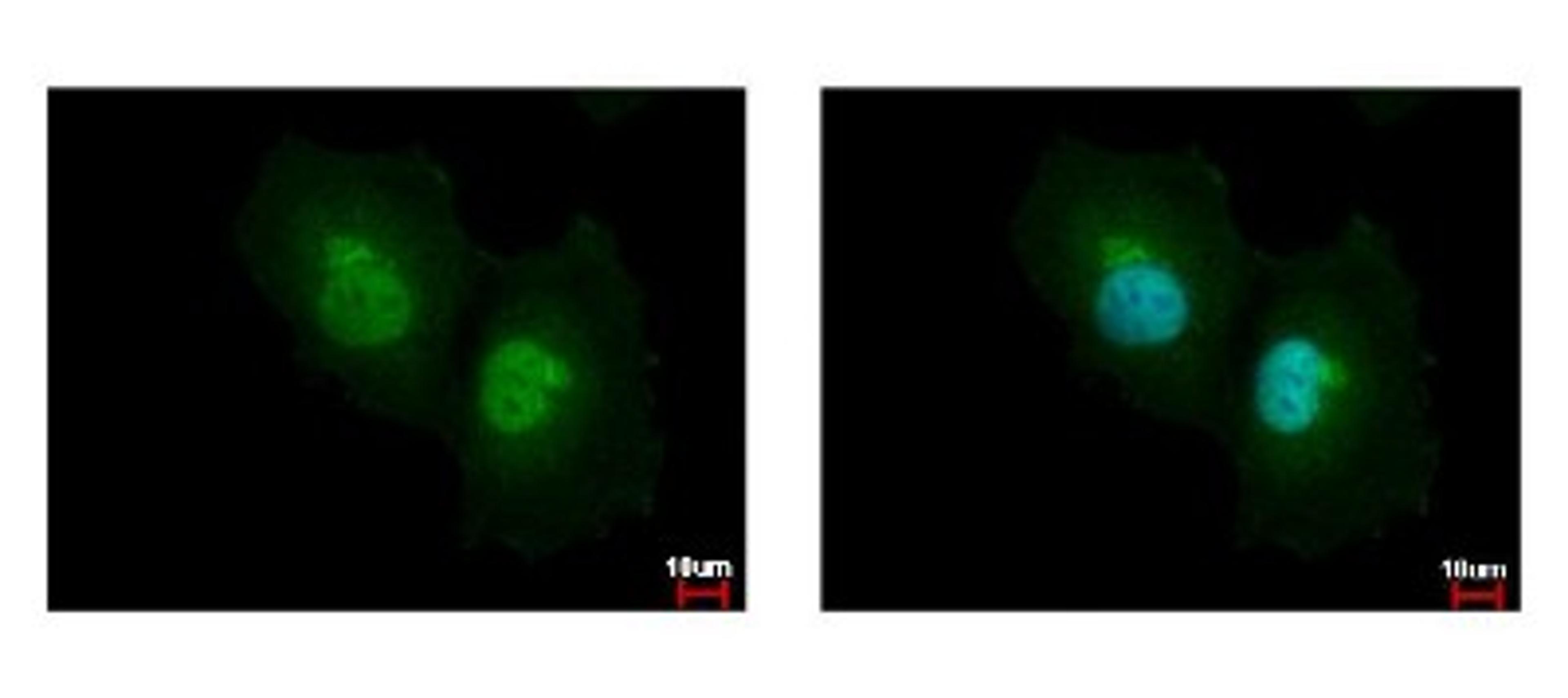 Immunocytochemistry/Immunofluorescence: Argininosuccinate Lyase Antibody [NBP1-32752] - Sample: HeLa cells were fixed in 4% paraformaldehyde at RT for 15 min. Green: ASL protein stained by ASL antibody diluted at 1:500. Blue: Hoechst 33342 staining.