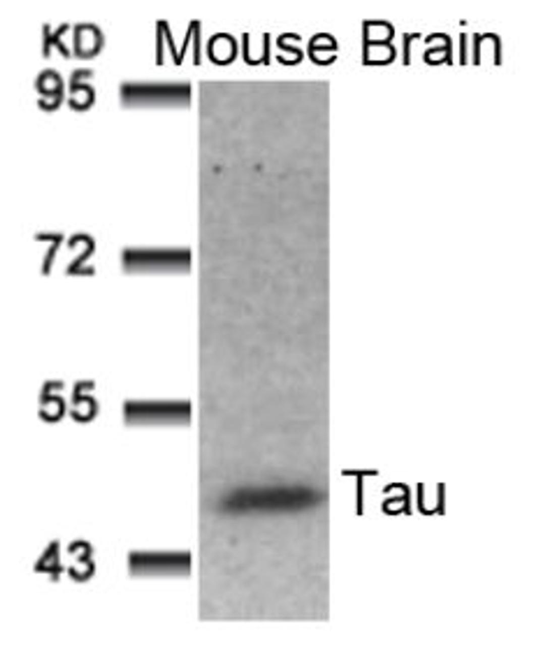 Western blot analysis of lysed extracts from Mouse Brain tissue using Tau (Ab-181).