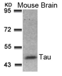 Western blot analysis of lysed extracts from Mouse Brain tissue using Tau (Ab-181).